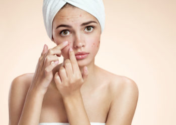 mädchen mit pickeln